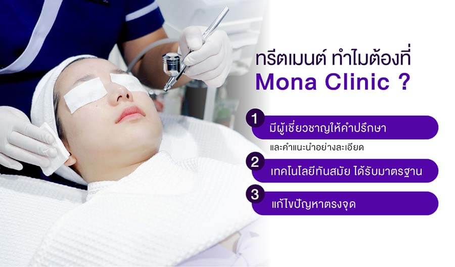 Why Mona Clinic-01 treatment